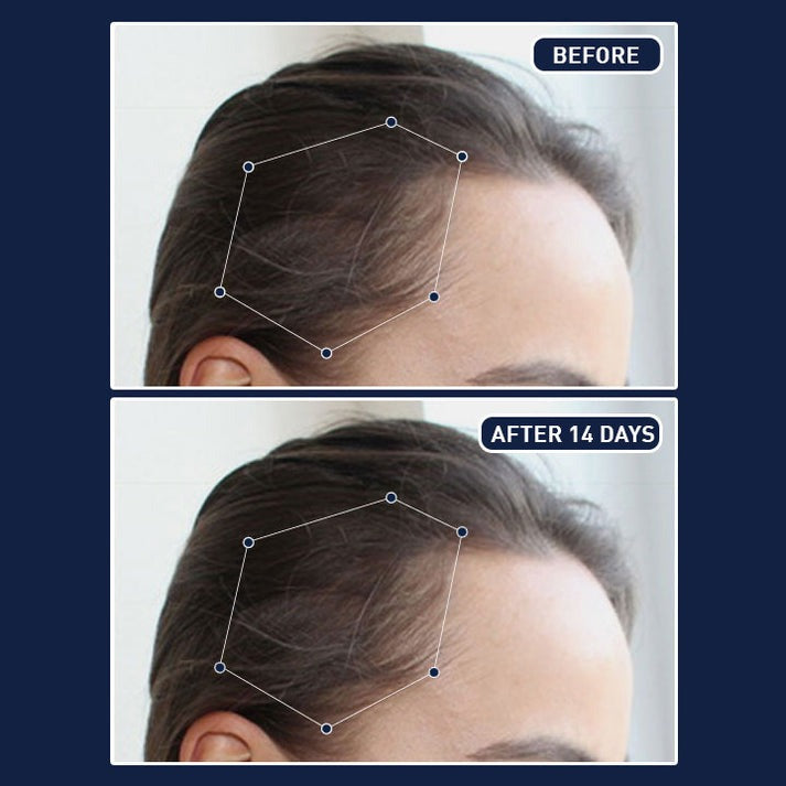 FEG- Hair Nourishing Spray (BUY 1 GET 1 FREE / RS- 1695)