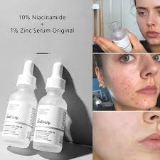 The Ordinary Niacinamide Serum (50%OFF)