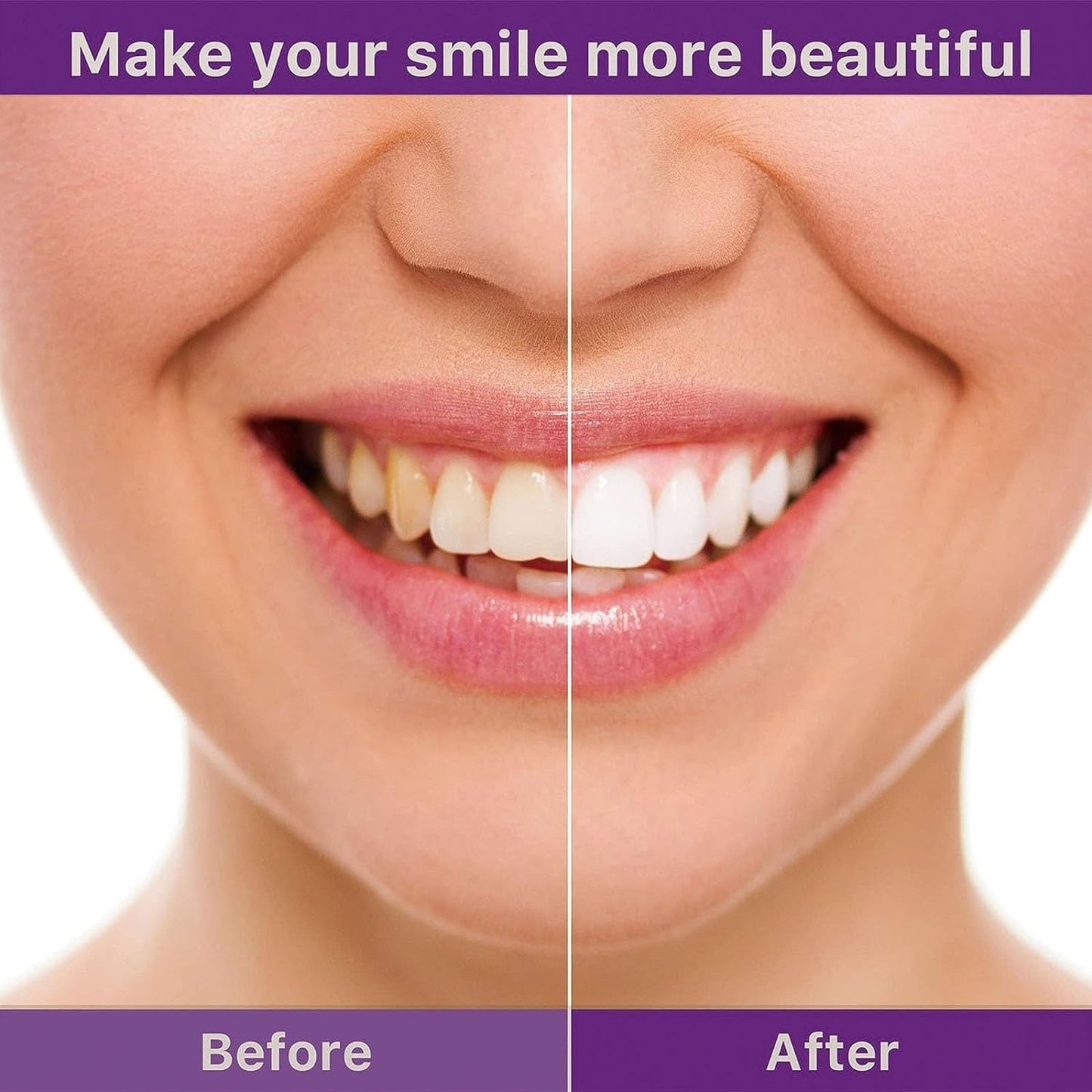 V34 Hi-Smile Teeth Whitener (RS-1295)