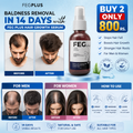 FEG PLUS- Hair Growth Spray 50ml (BUY 1 GET 1 FREE)