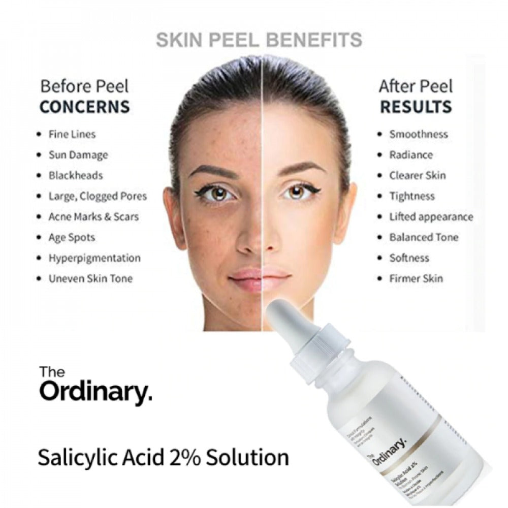 The Ordinary Niacinamide  Serum (50%OFF)